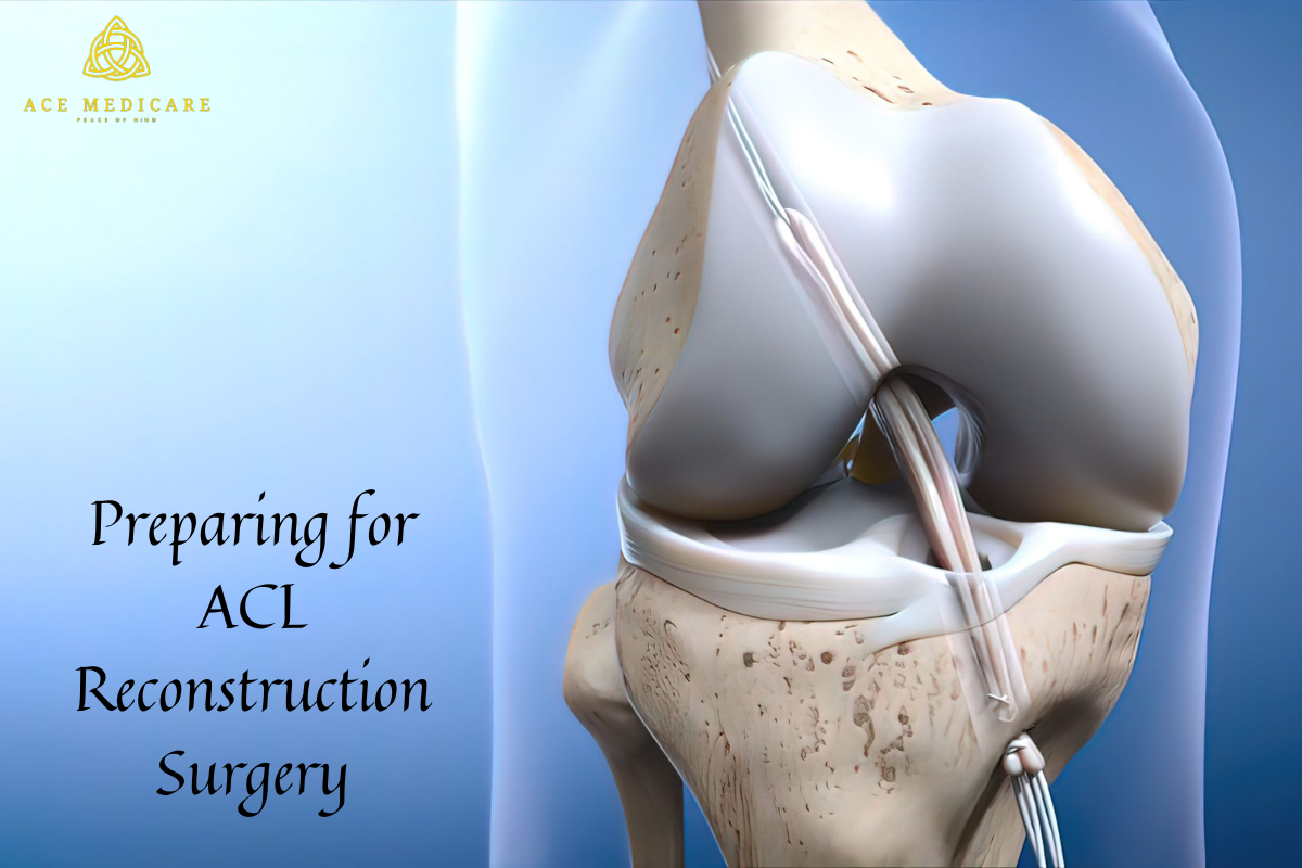 The Ultimate Guide to Preparing for ACL Reconstruction Surgery: Tips and Advice